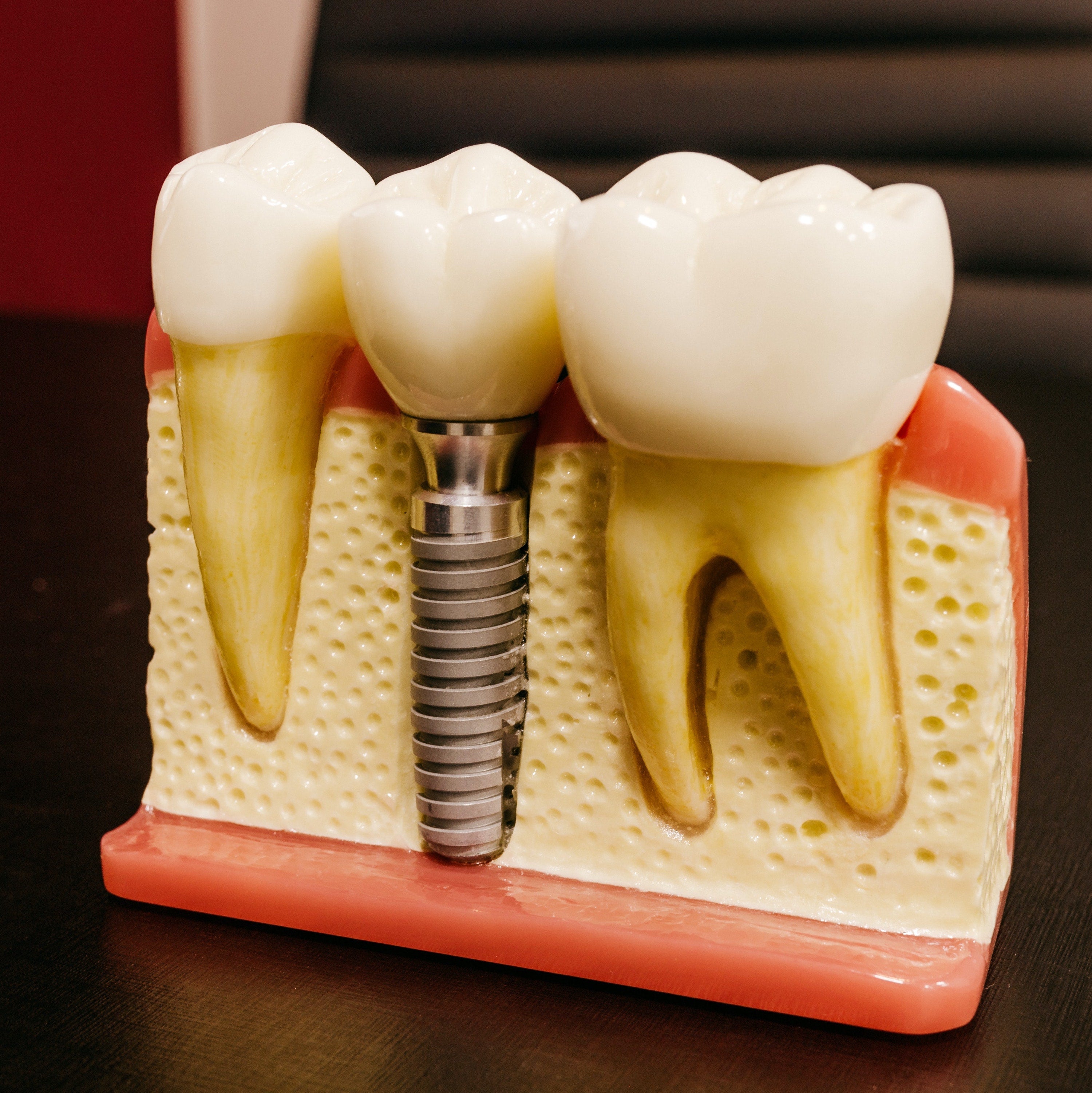 Are Zima's tablets compatible with cobalt chromium dental appliances? (2026) - Dr. Jack Pinnar-Smith