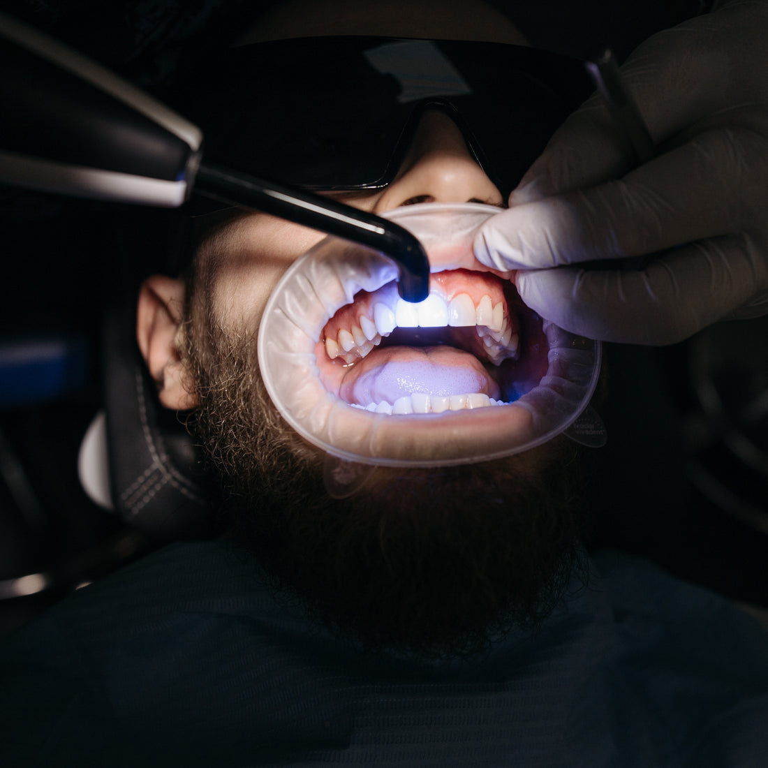 Why doesn't the Dental pod have a UV light? (2024)